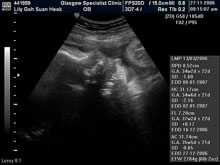 Vivian Sonograms
